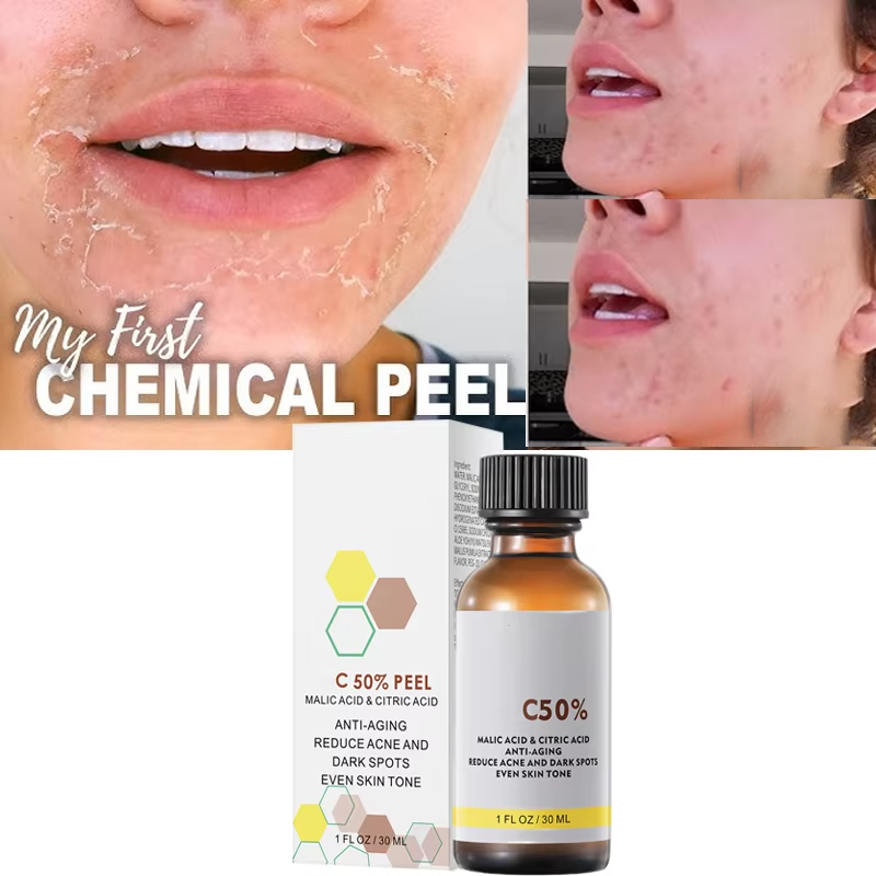 Salicylic Acid Cleanser - Mit Malicsäure und Zitronensäure für das