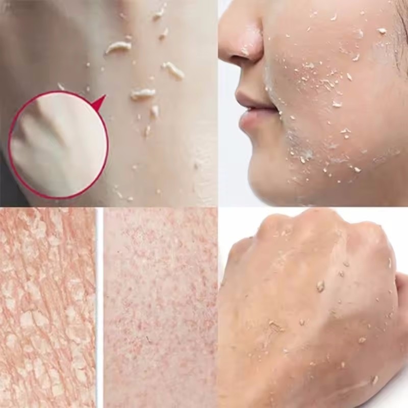 Orange Peeling Peeling Gel Ges – Ceramide Moisturizer Bewertung und Preis