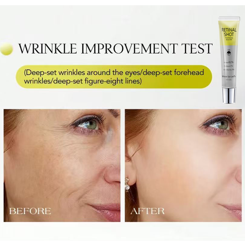 Retinal 0,1% Intensiv-Pantheno – Caffeine Eye Serum Bewertung und Preis
